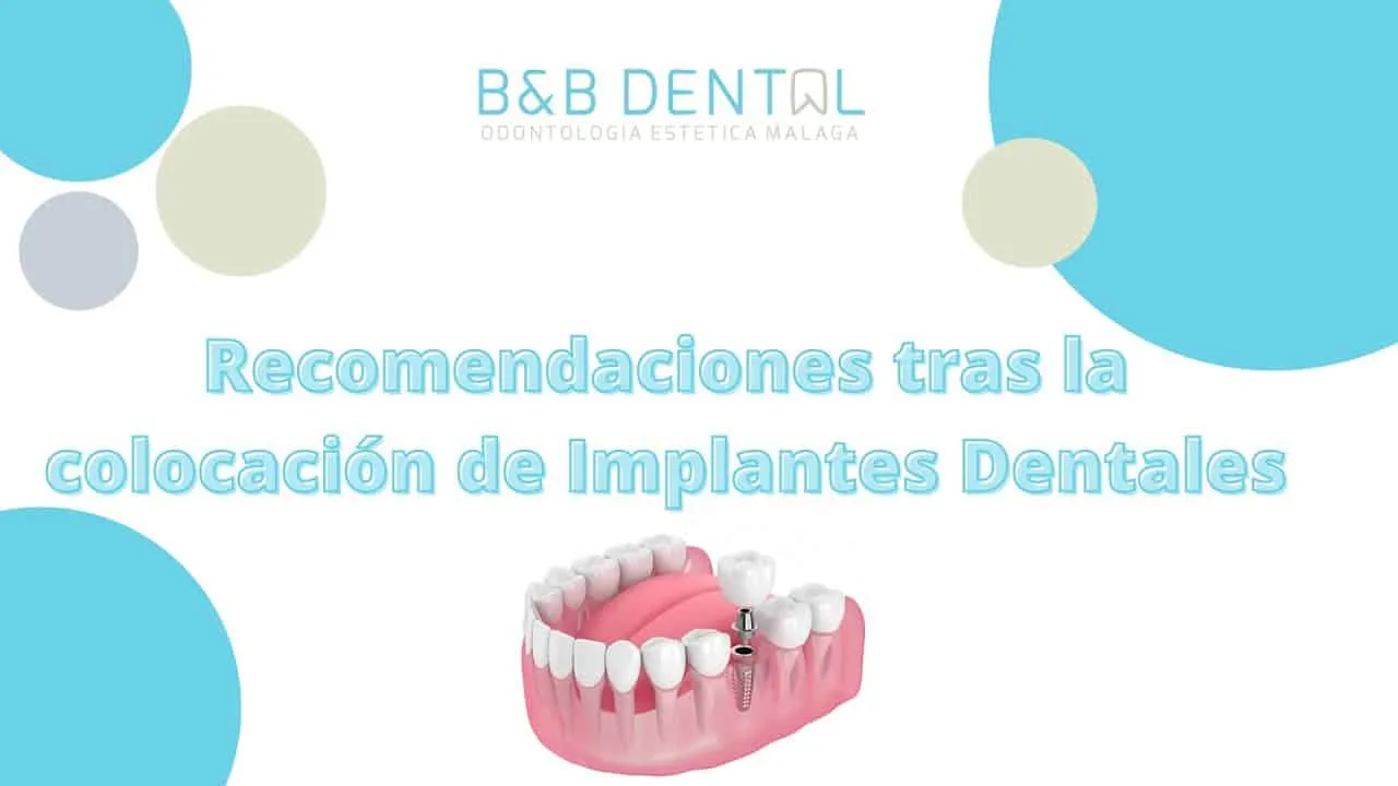 Consejos para tu tratamiento de Ortodoncia