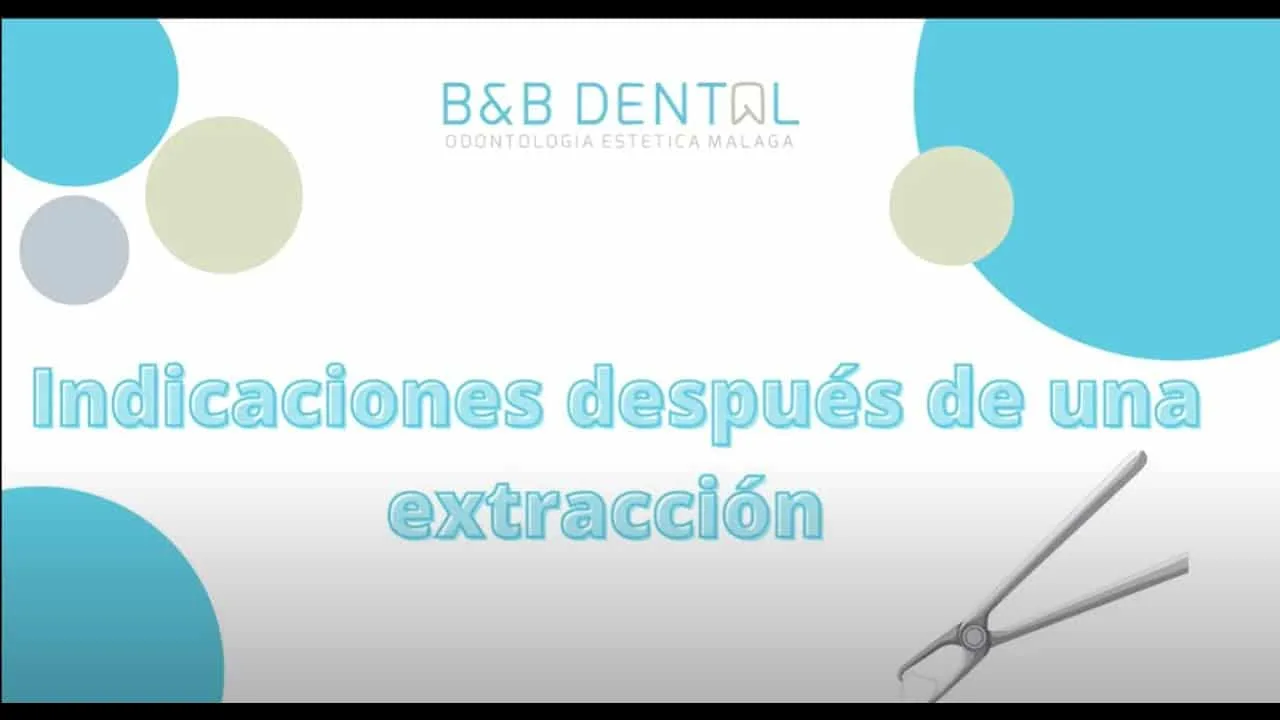 Indicaciones después de una extracción