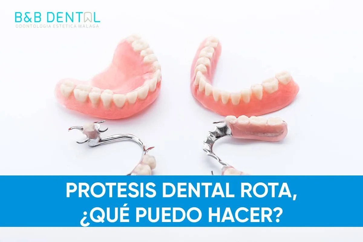 Prótesis dental rota, ¿Qué puedo hacer?