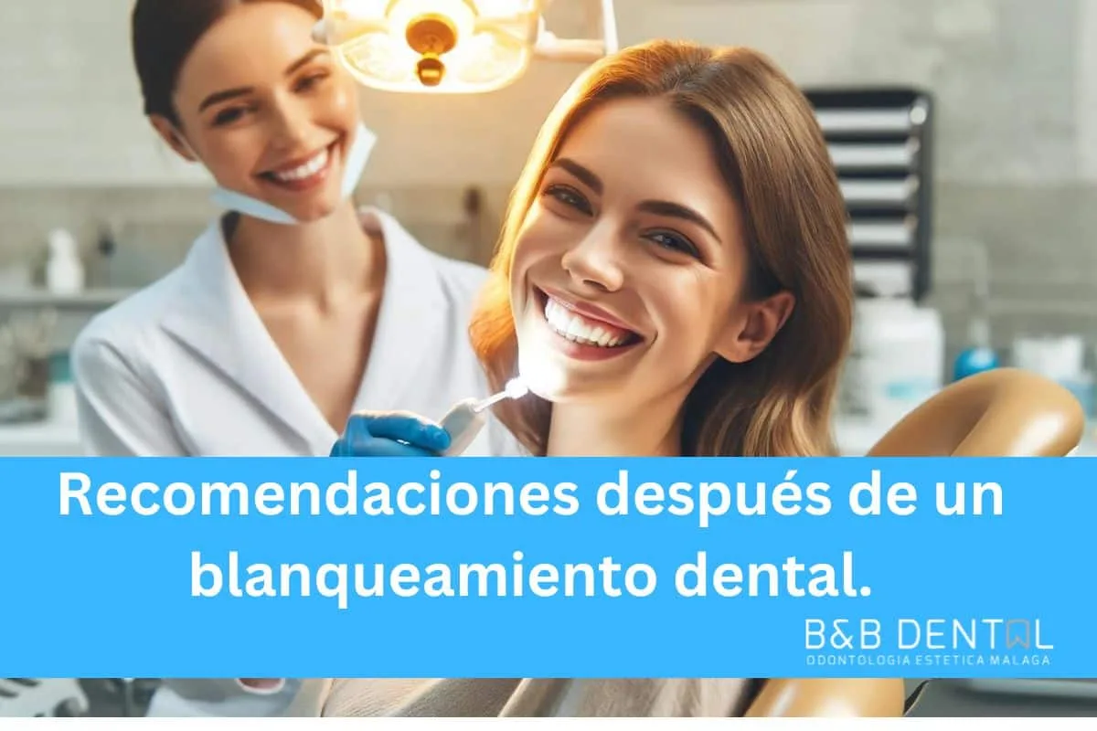 Blanqueamiento dental: cuidados para que dure más