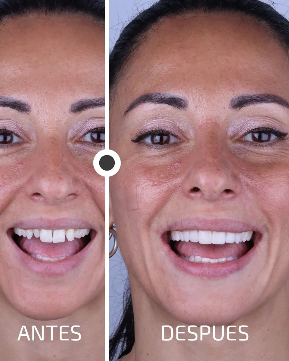 Caso real de transformación dental ByB Dental 16