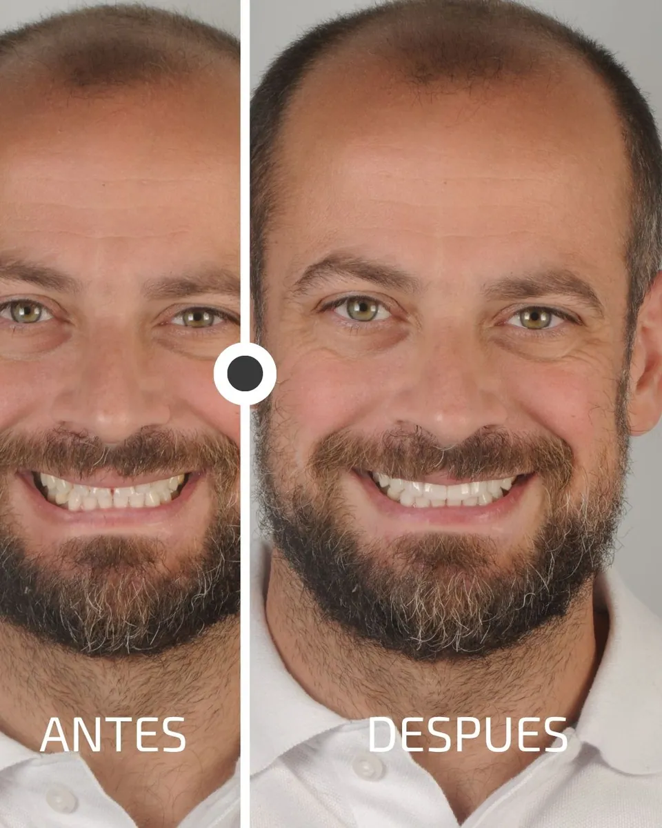 Caso real de transformación dental ByB Dental 2