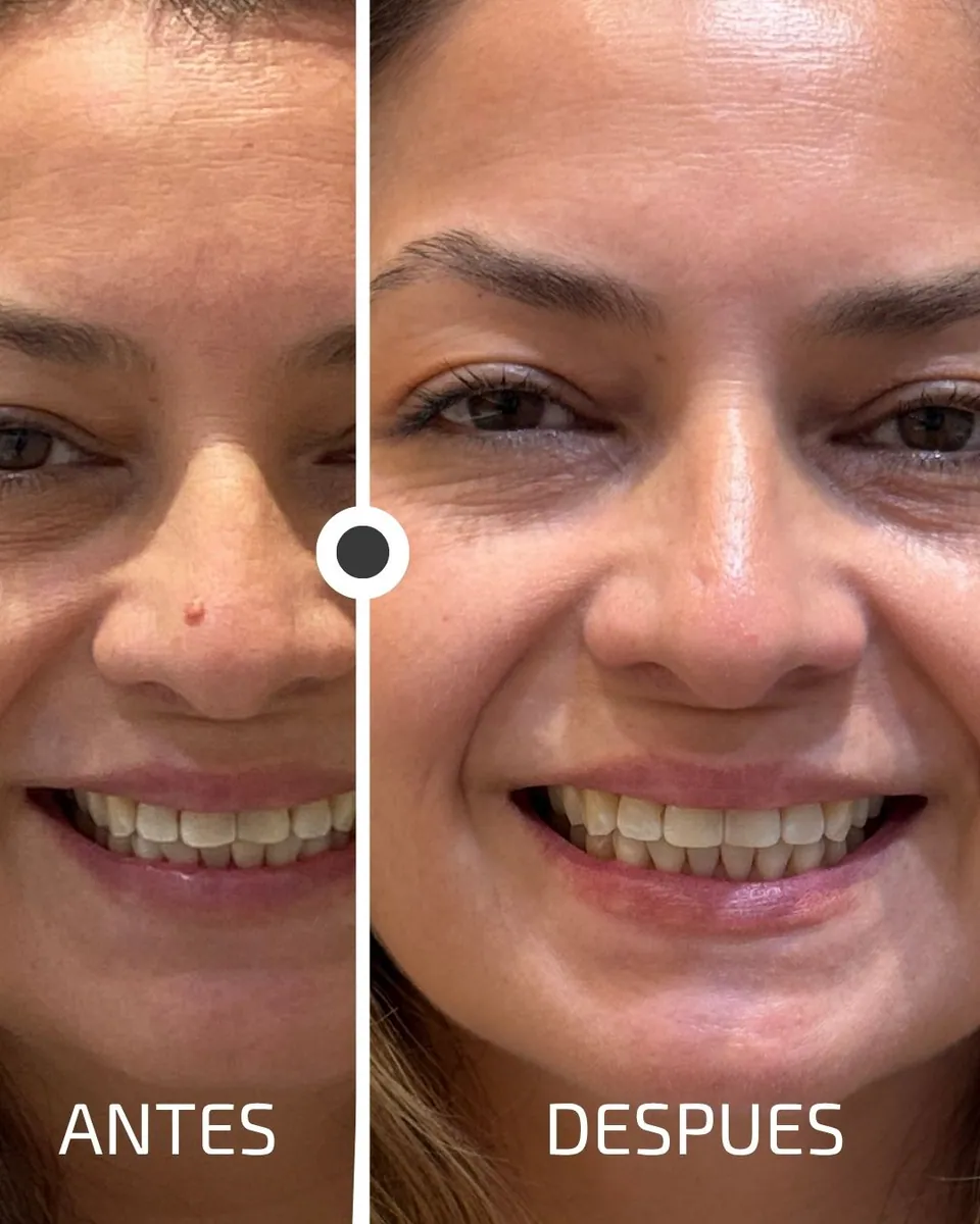 Caso real de transformación dental ByB Dental 20