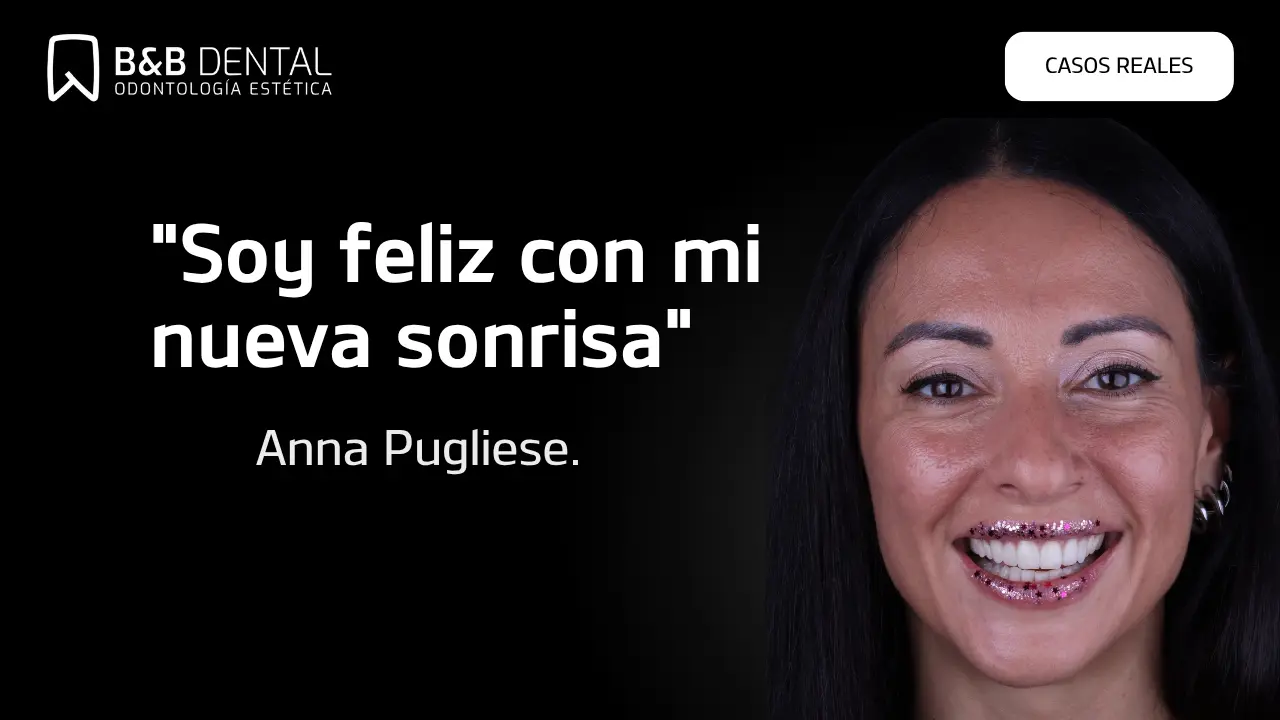 Anna Pugliese, real patient story at ByB Dental