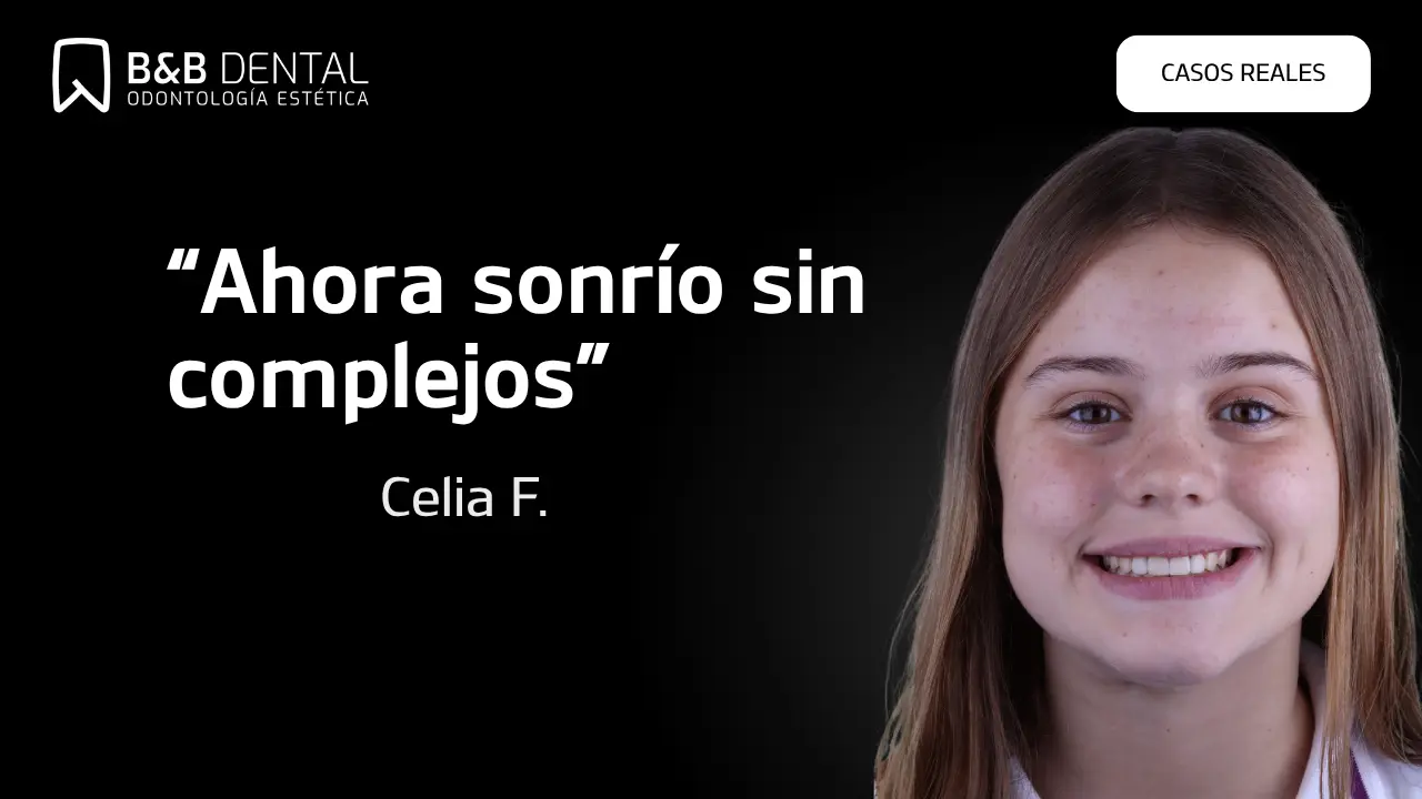 Celia Frank, real patient story at ByB Dental
