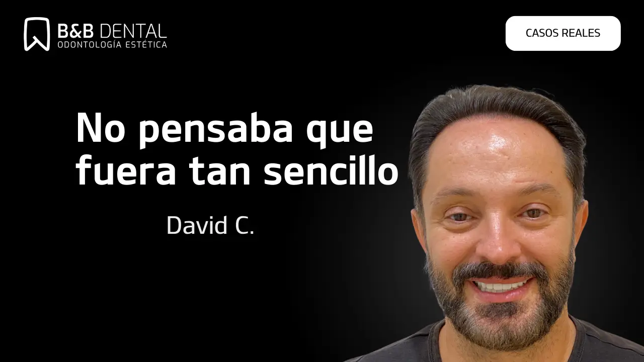 David Carrasco, real patient story at ByB Dental