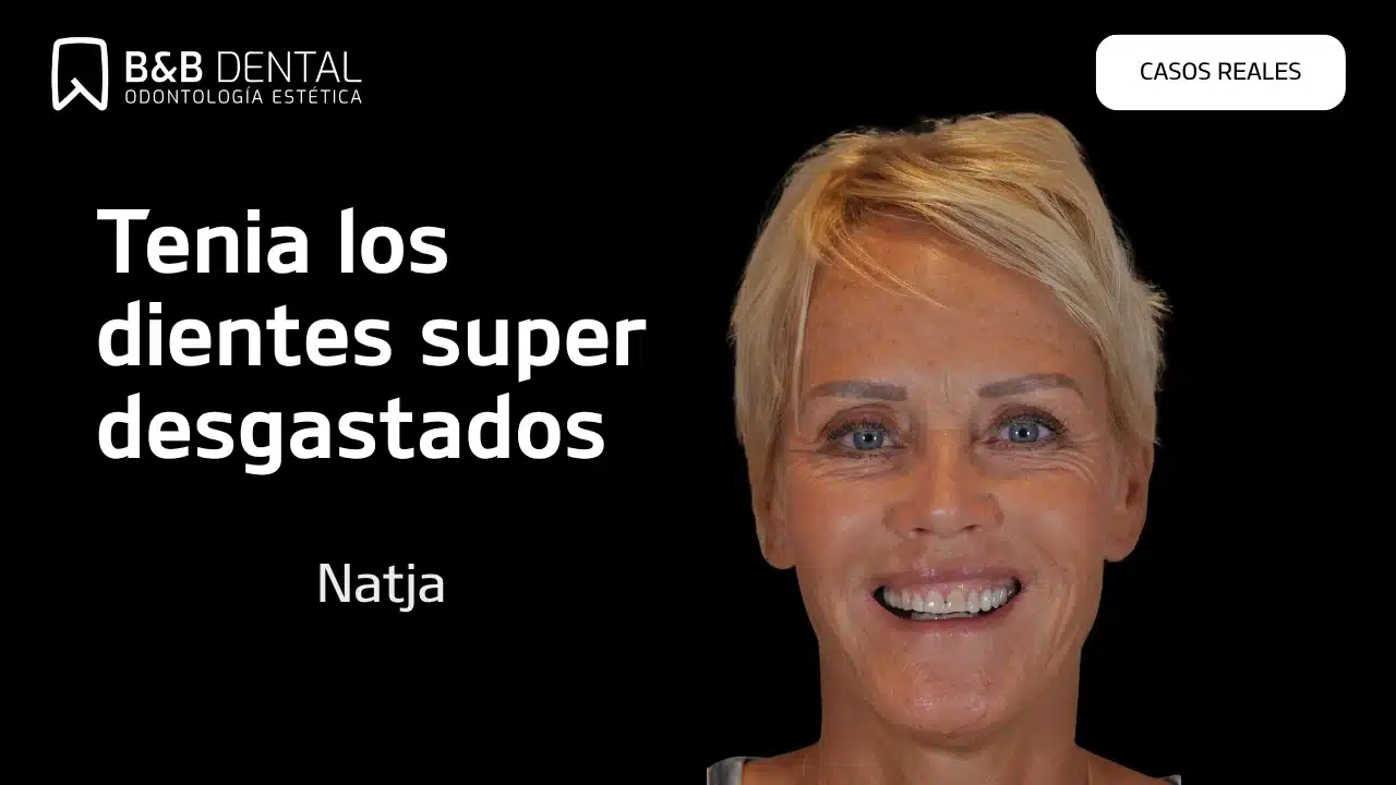 Natja, real patient story at ByB Dental