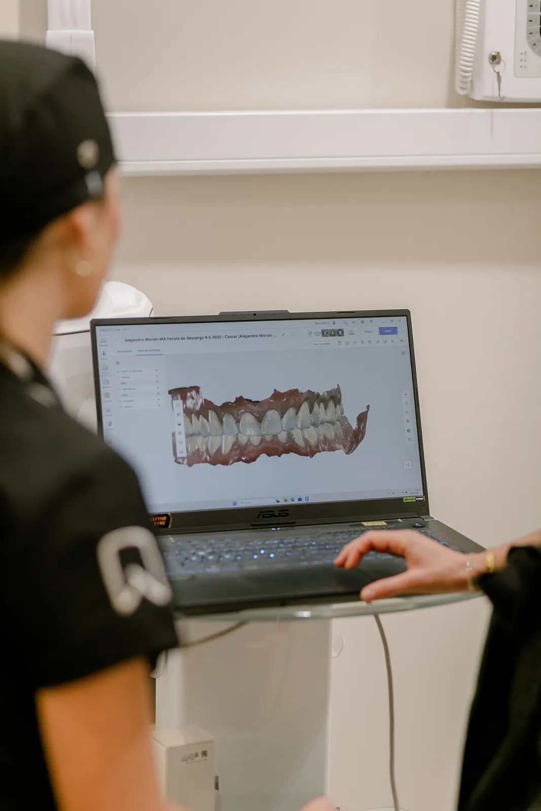 Escáner intraoral y planificación digital para ortodoncia invisible en ByB Dental