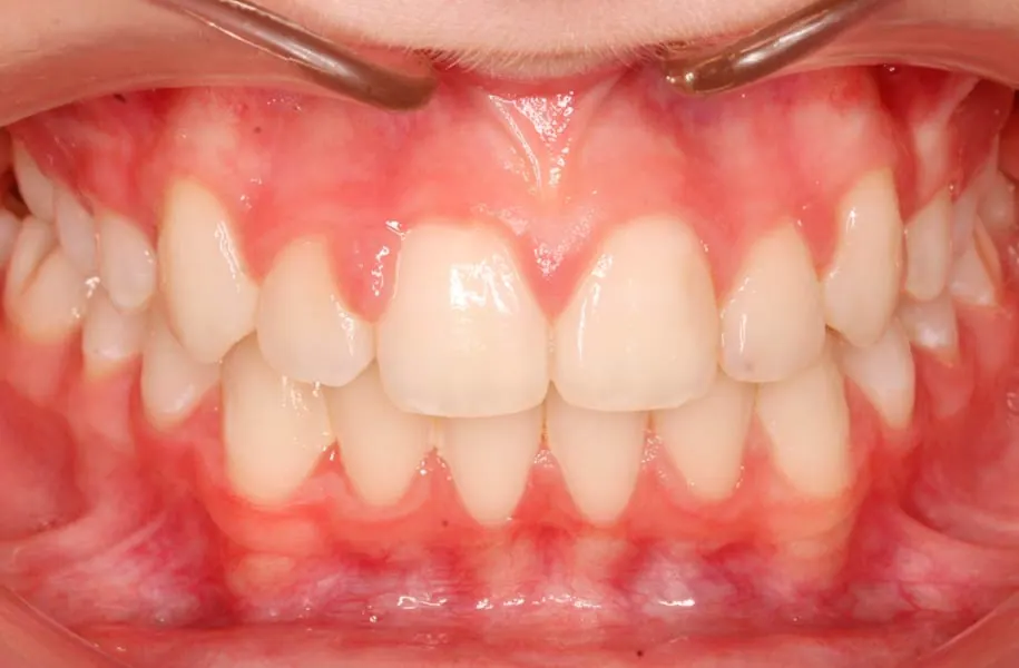 After children's dentist in málaga treatment at ByB Dental