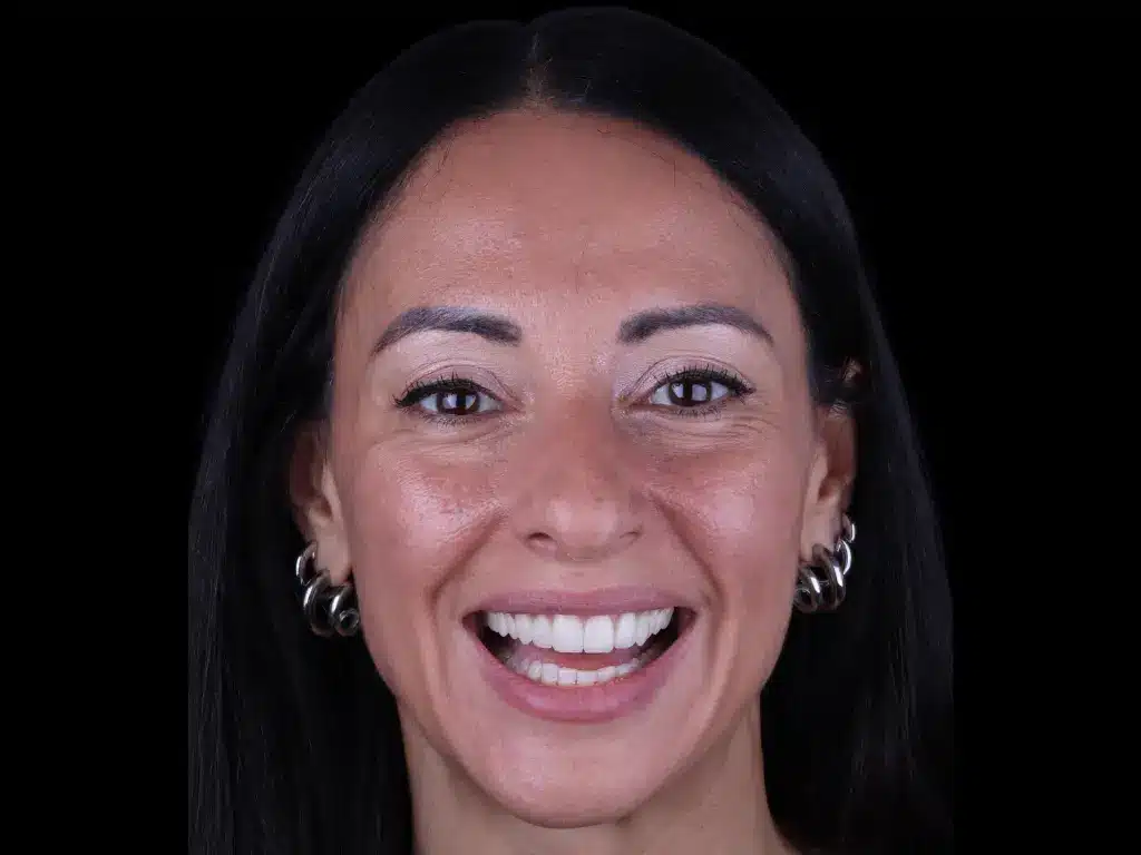 Anna Pugliese, real patient story at ByB Dental