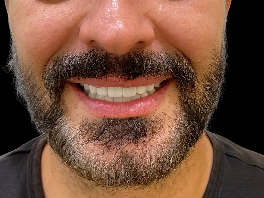After treatment: David Carrasco