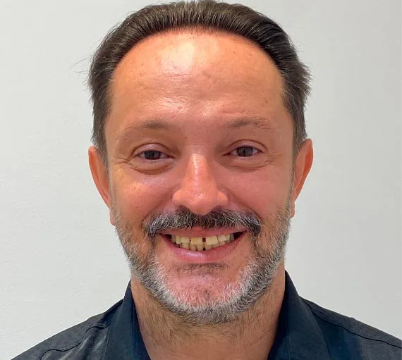 Before treatment: David Carrasco