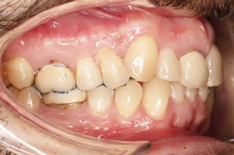 Before treatment: José