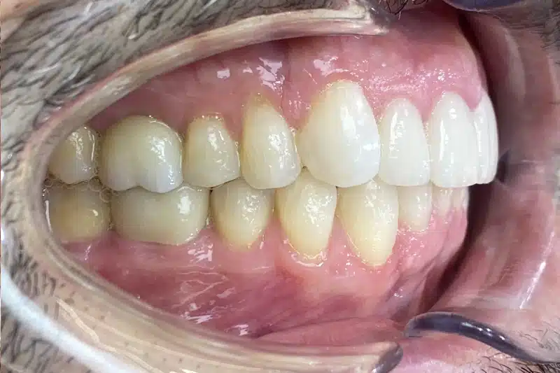 After treatment: José