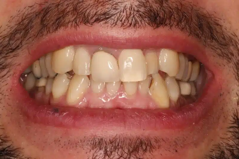 Before treatment: José