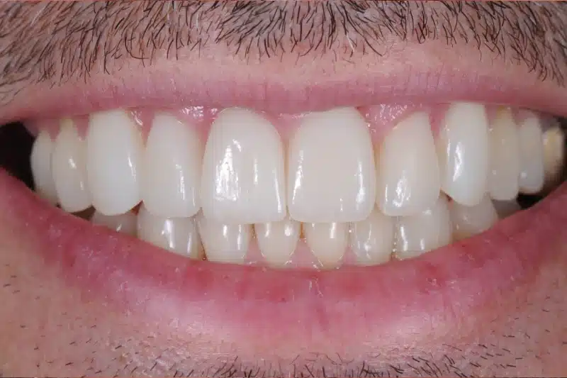 After treatment: José