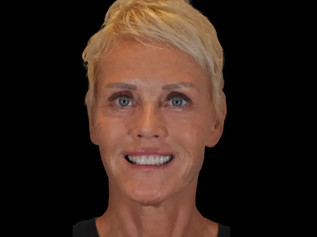 Natja, real patient story at ByB Dental