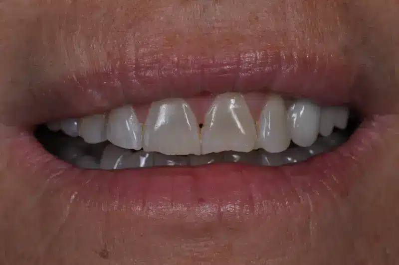 Before treatment: Natja