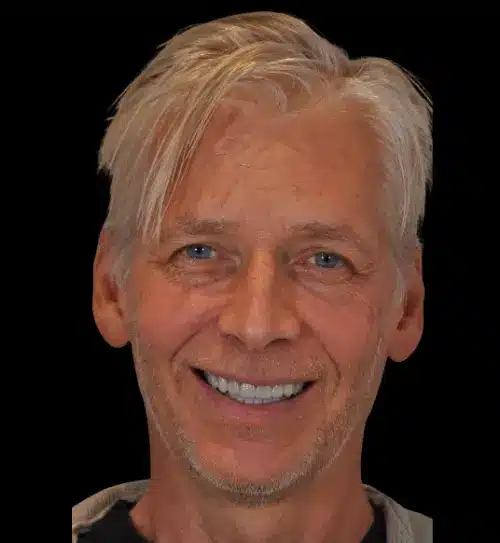 After treatment: Nils