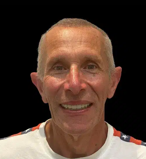 After treatment: Richard