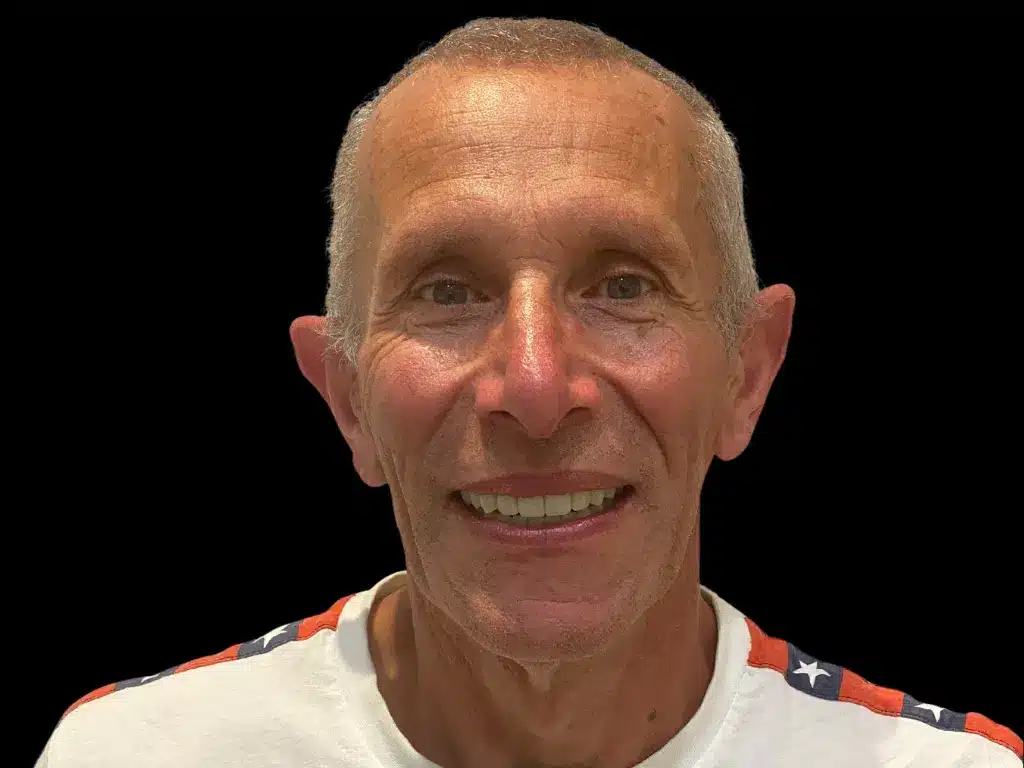 Richard, real patient story at ByB Dental