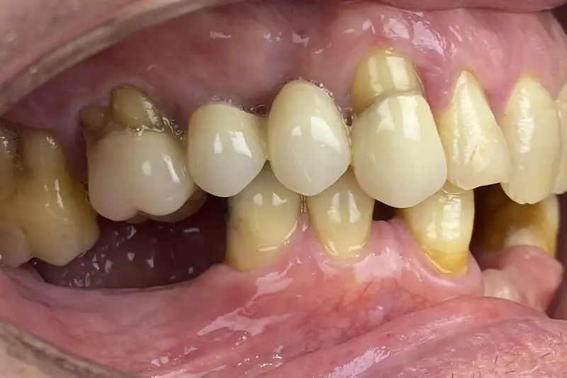 Before treatment: Richard
