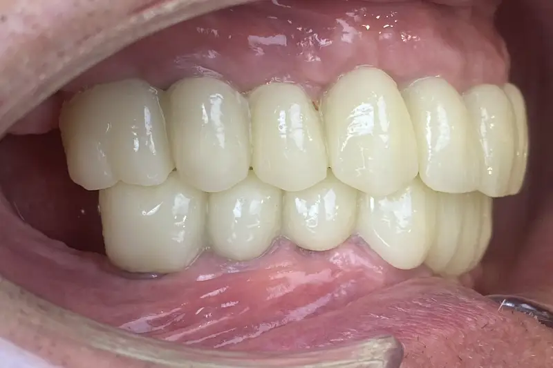 After treatment: Richard