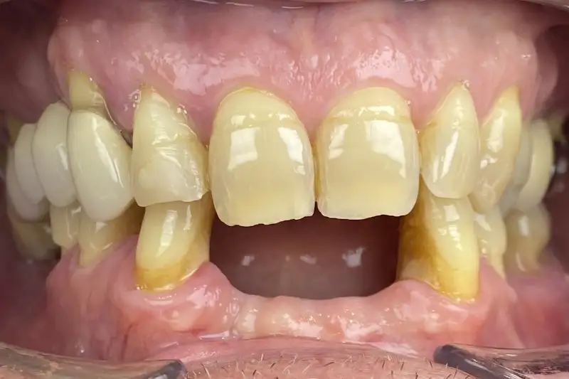 Before treatment: Richard