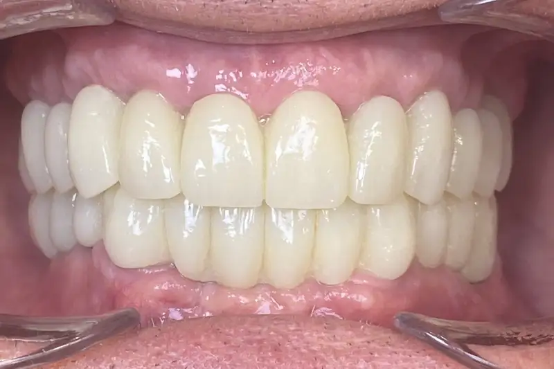 After treatment: Richard