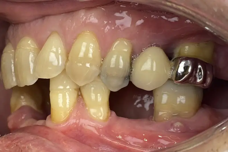 Before treatment: Richard