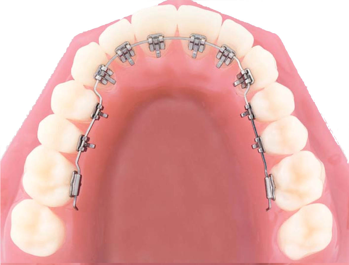Ortodoncia ronda y malaga