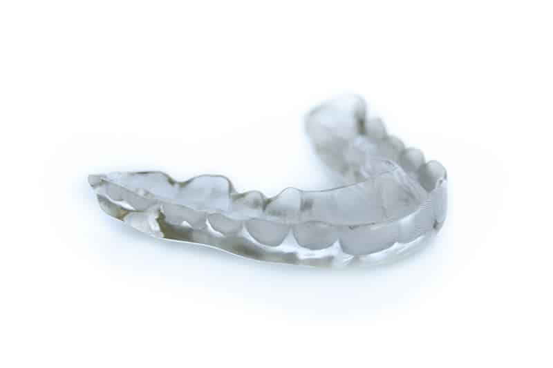 ¿Por qué el bruxismo es un gran problema y cómo solucionarlo?