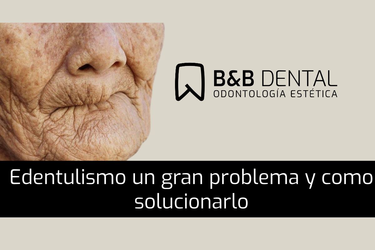 Problemas de no tener dientes