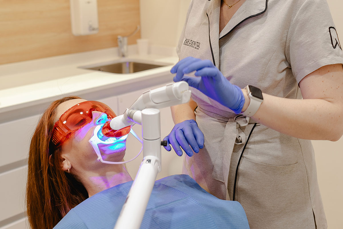 teeth whitening malaga clinic