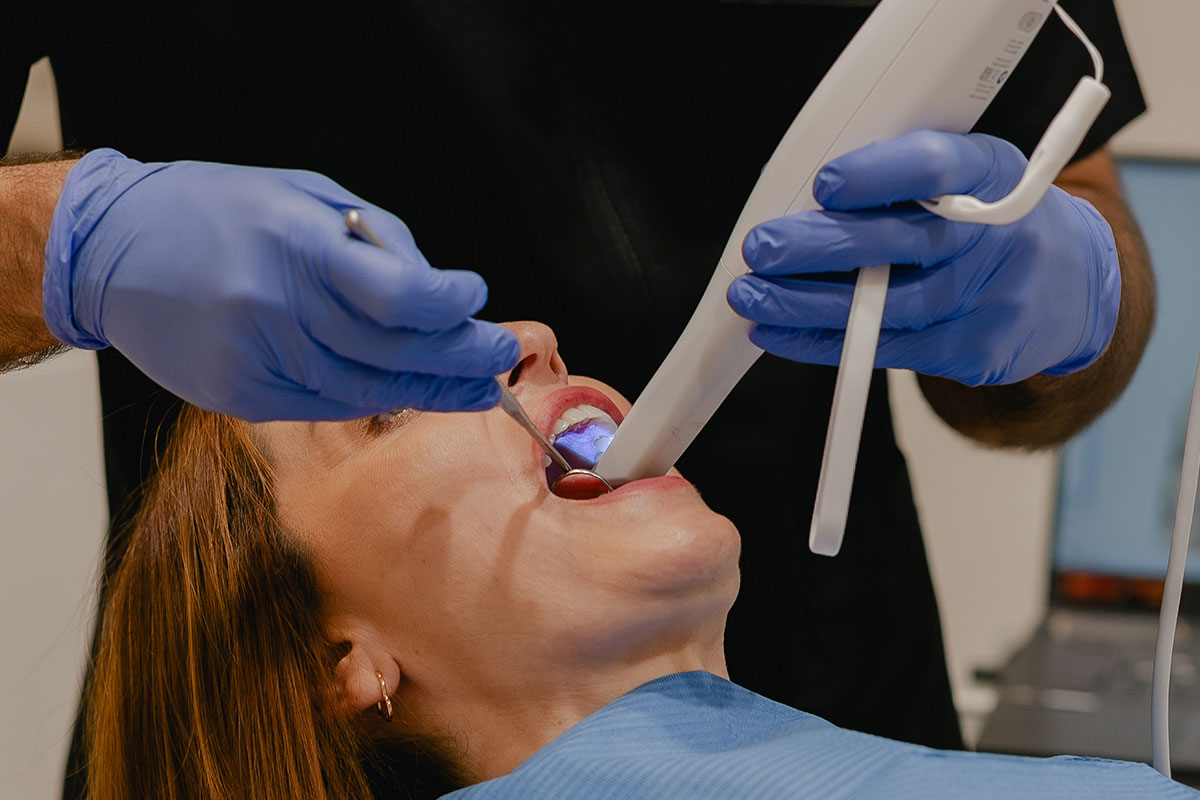 tooth whitening malaga