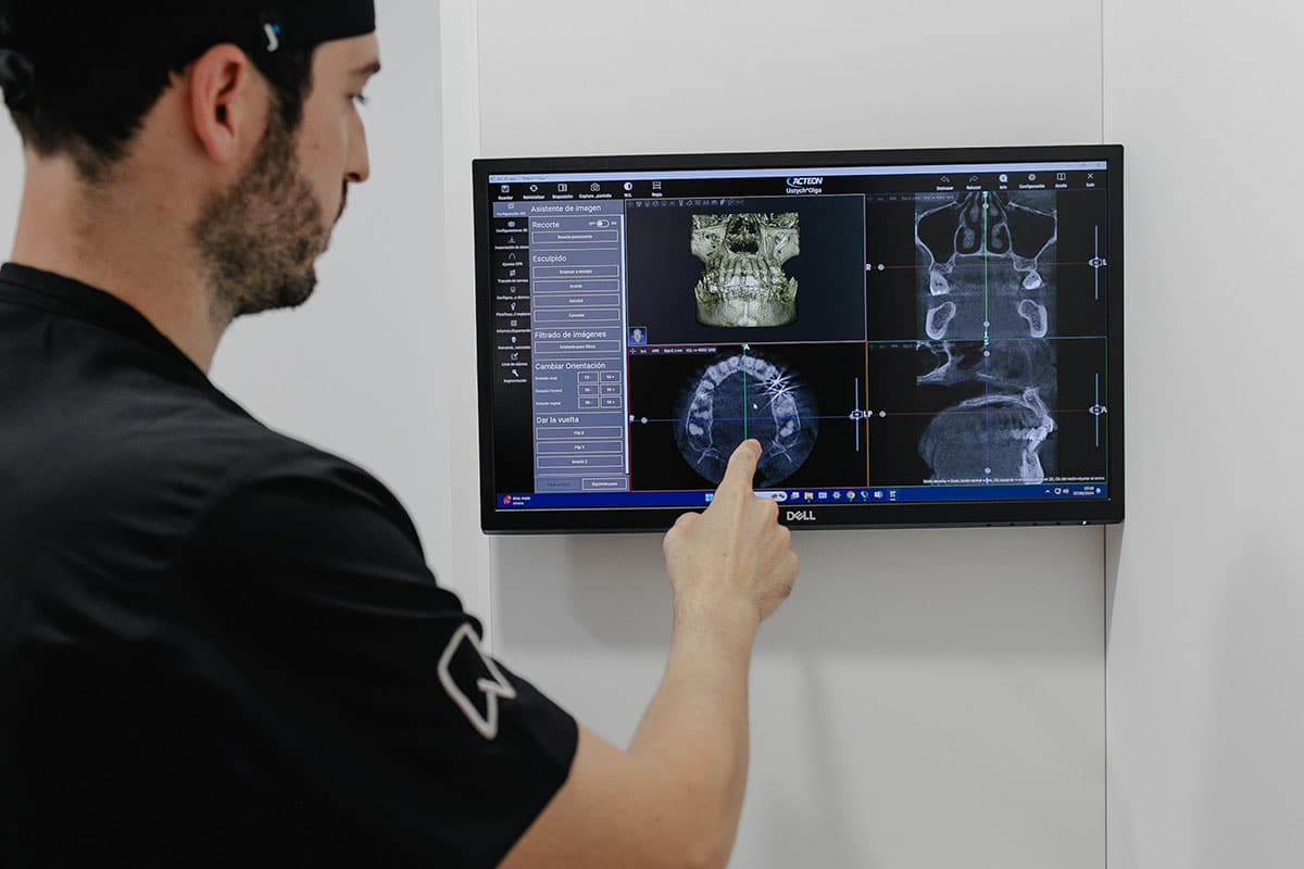 dental prosthesis price malaga