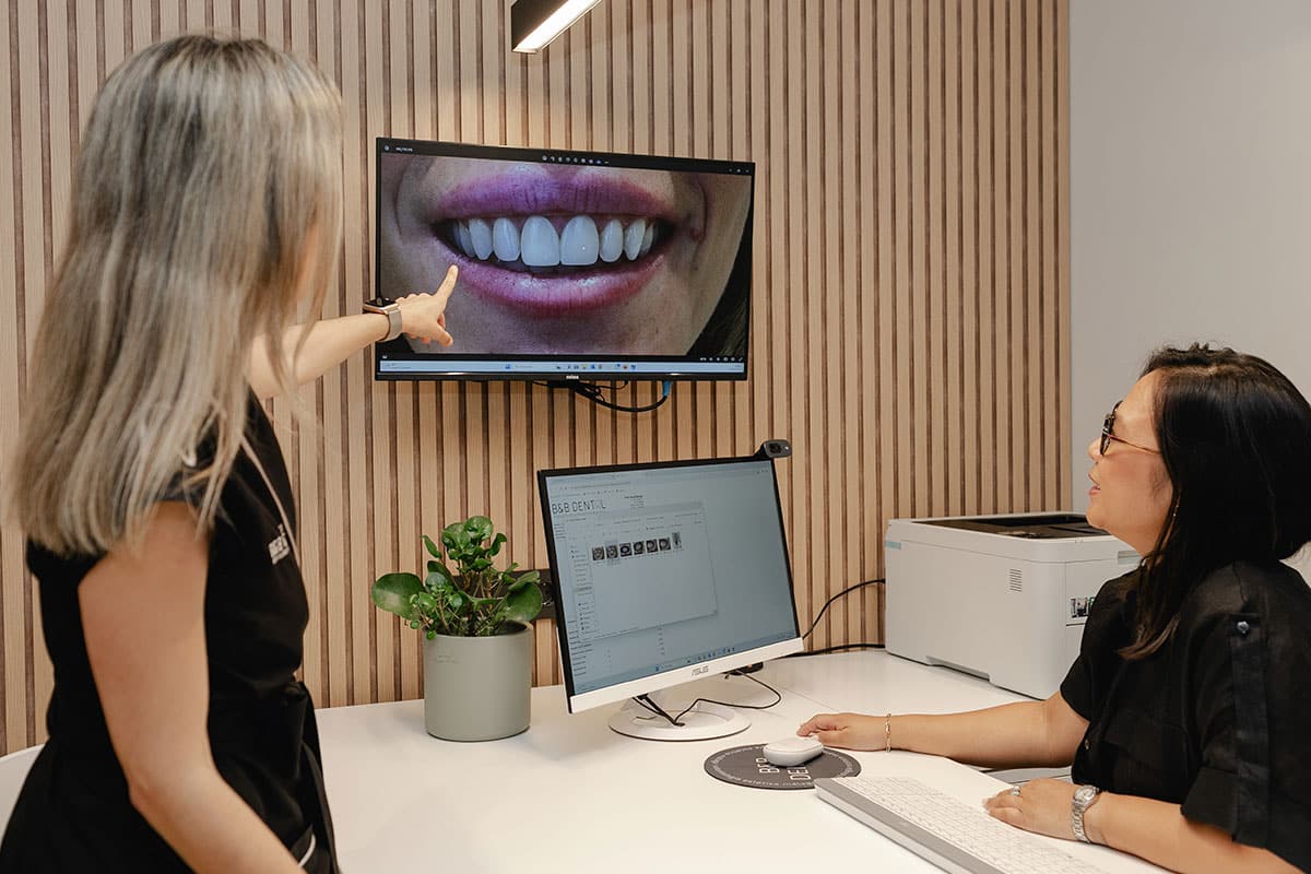 porcelain veneers malaga price