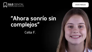Celia Frank Celia Frankde éxito en ByB Dental con ortodoncia y carillas dentales en Málaga